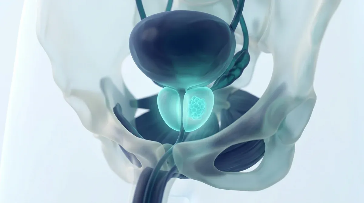 Render médico tridimensional de la próstata destacada en la pelvis